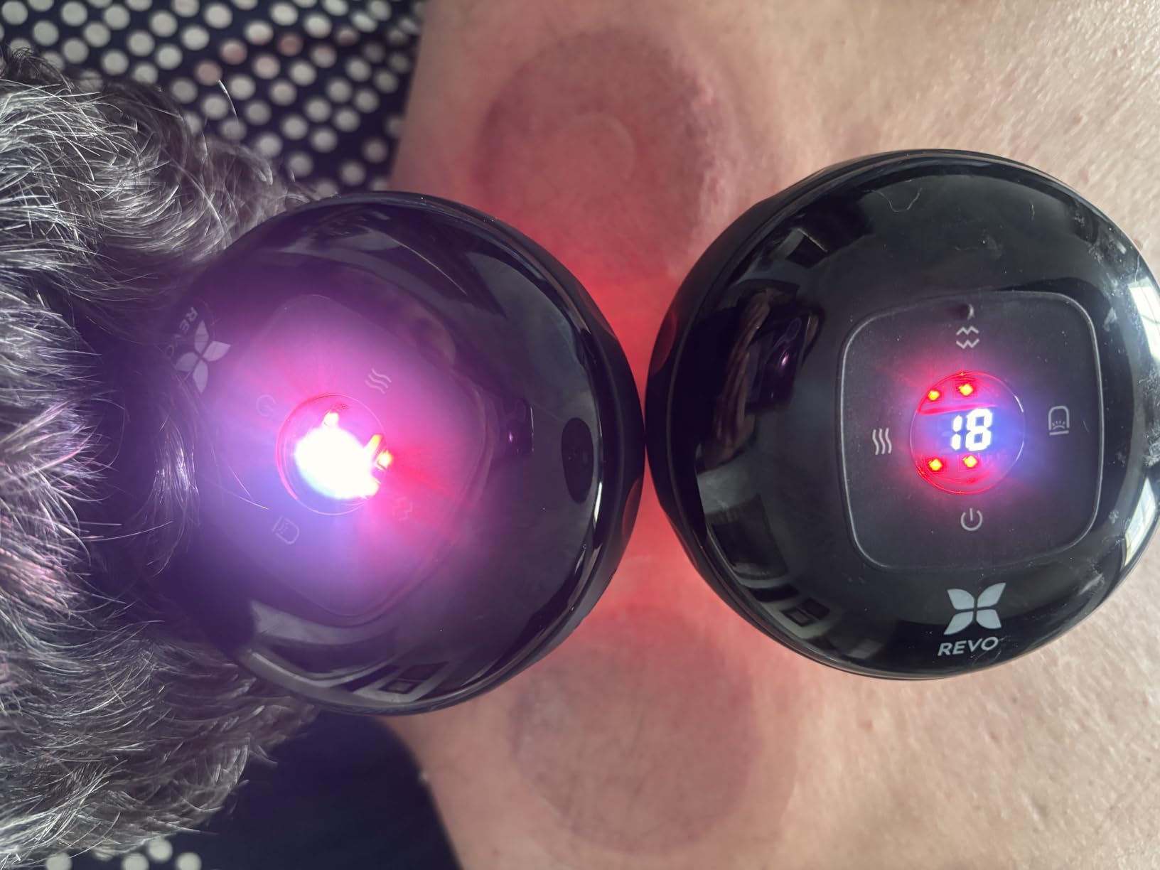 REVO The Original 4-in-1 Smart Cupping Massager with LED Light, Heat, Dynamic Suction & Vibration Massage, Portable Cordless Rechargeable Cupping Device for Body- 1 Pack customer photo 2