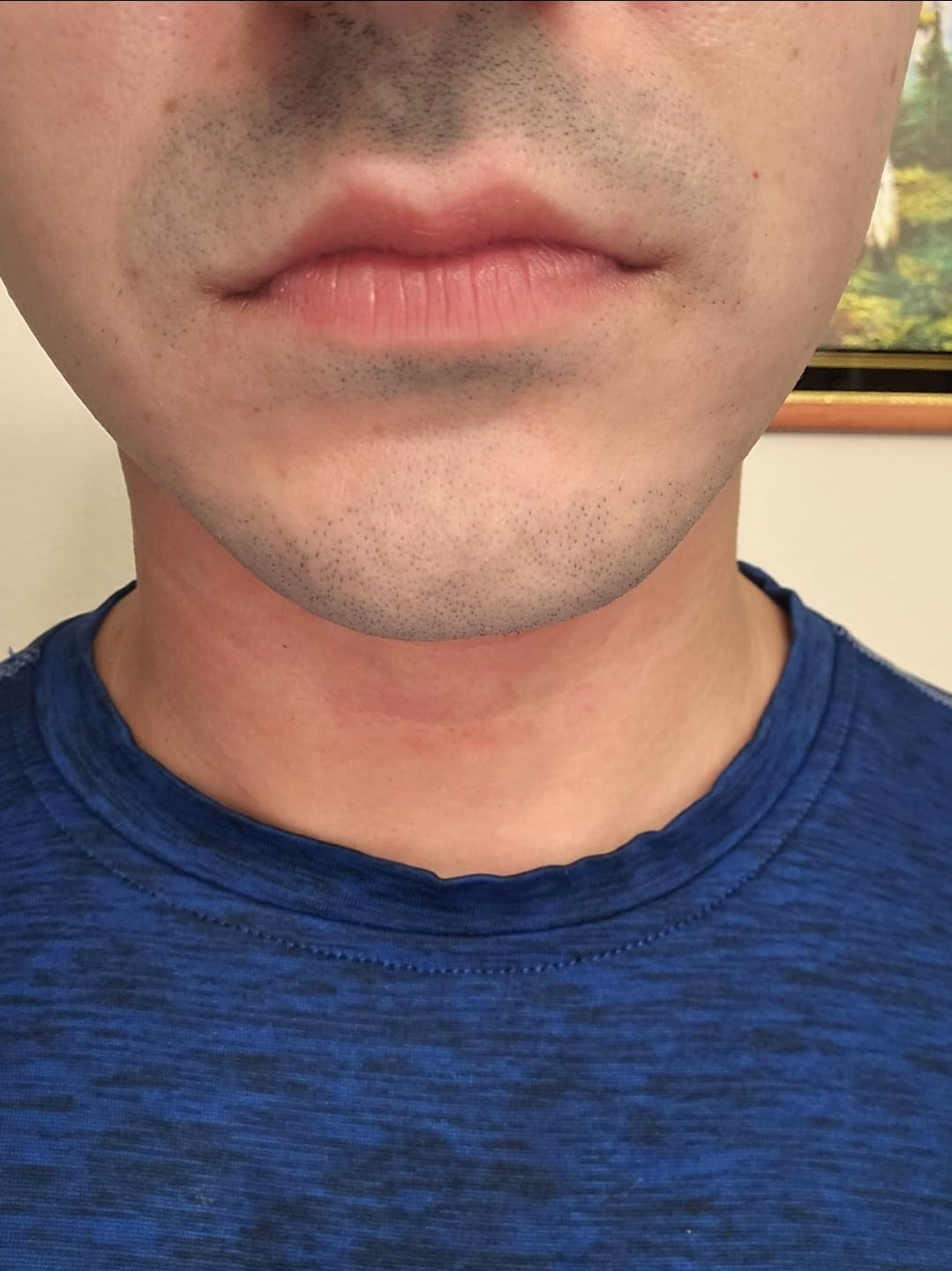 VOYOR Electric Razor for Men, Rotary Shaver, 3D Floating Heads, Wet & Dry customer photo 2